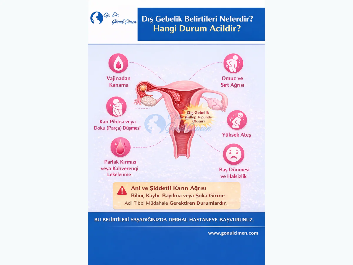 Dış gebelik belirtileri nelerdir? hangi durumlar acildir!